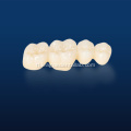 Multilayerd Full Zirconia Dental Restoration